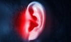 the-debilitating-influence-of-tinnitus,-and-how-a-brand-current-app-might-per-chance-abet-–-podcast-–-guardian