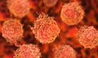 new-screening-trial-would-possibly-set-thousands-from-prostate-most-cancers-–-guardian